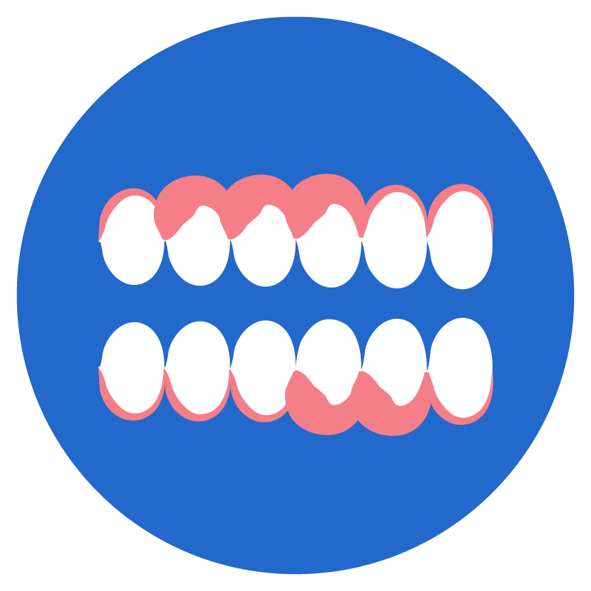 Swollen Gums
